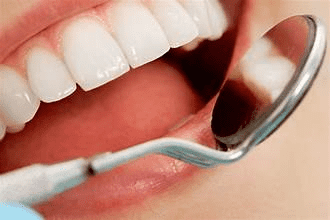 Dental Implant Specialist